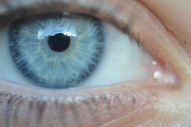 Einführung in die Irisdiagnose, die Diagnose aus dem Auge